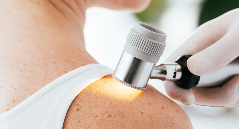 dermatologia dermatologia