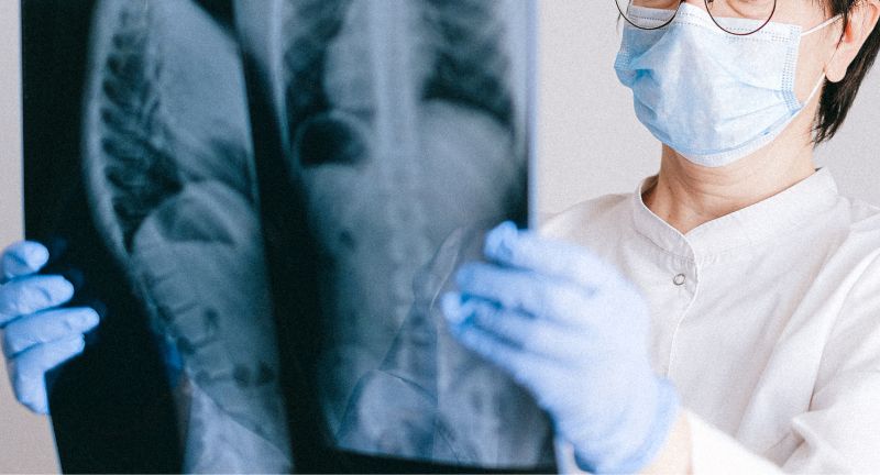 mammografia mammografia